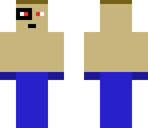 boxer with a black eye 2