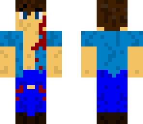 plane crash survivor