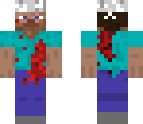 wounded steve