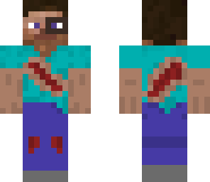 injured steve