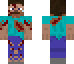 hurt steve