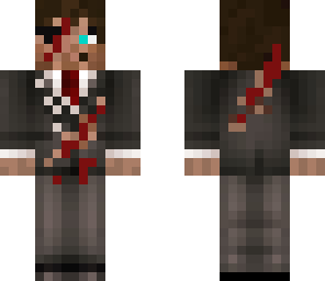 injured suit bussinessman