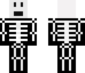x-ray steve