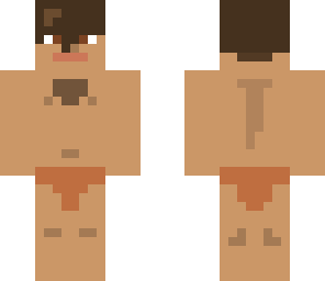 my sjin