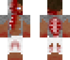 infected by zombies