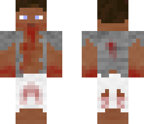 infected by virus