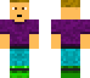 connor\'s skin