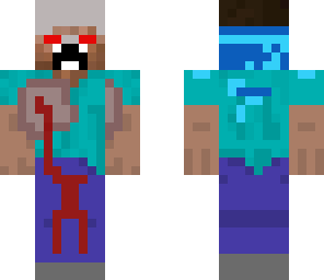 hurted steve