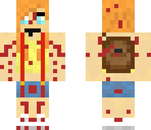 misty edited hurt