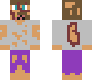 man after car acident zombie