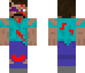 beaten up steve
