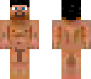 fixed
