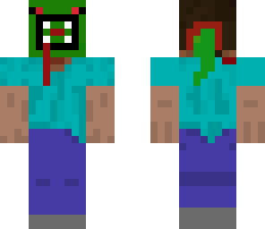 steve infectet