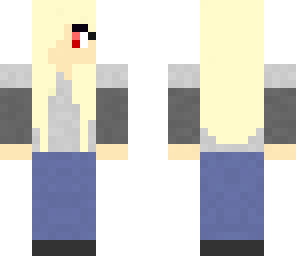 albino girl