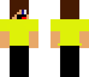 myskininepicness