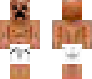 my skin