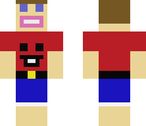 my skin