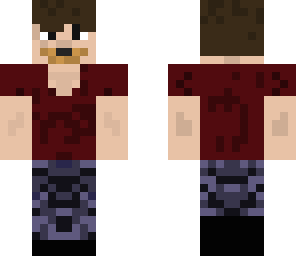 juan's skin