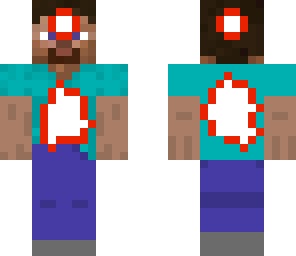 steve injured