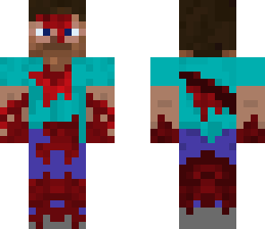 injured steve