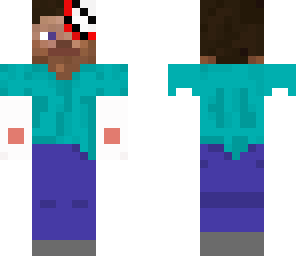 injured steve