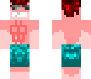 sunburnt man skin