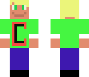 carlo's skin
