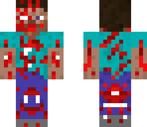 injured steve
