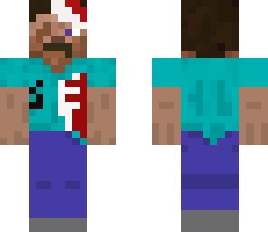 wounded steve