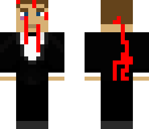dead bond