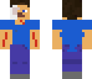 very damaged steve