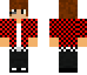 kyle's skin