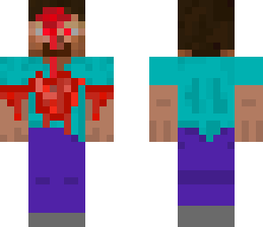wounded steve