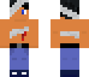 xk injure