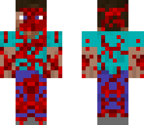 injured steve