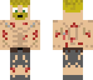 injured man