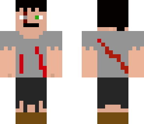 my personal skin take if u want