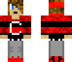 mike's skin