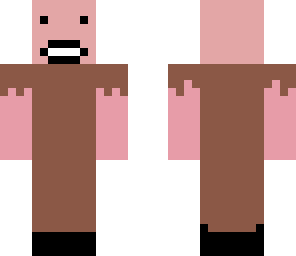 normal notch