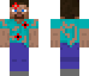 injurd steve