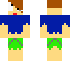 thomas skin