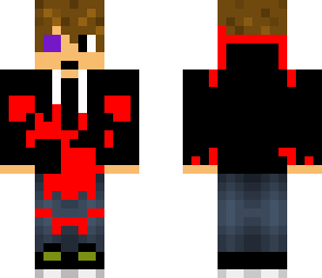 beaten up boy
