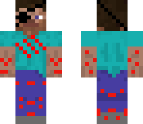 injured steve