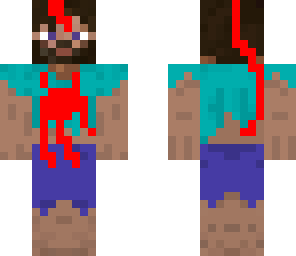 wounded steve