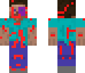 beaten up steve