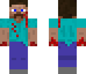 injured steve