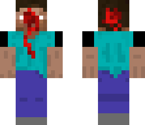 shot through the head