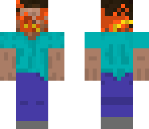 my head is on fire