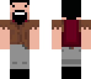 notch with hair on his head