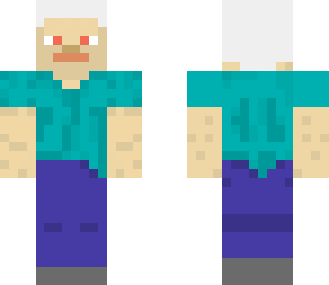 albino steve